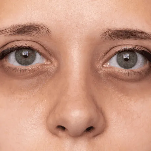 Tired, Dull, Washed-Out Skin